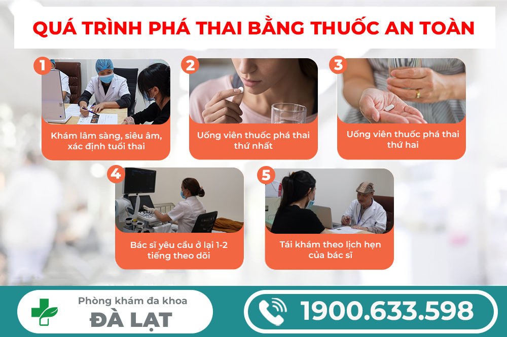 Hình ảnh minh họa